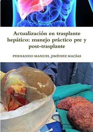 ACTUALIZACIÓN EN TRASPLANTE HEPÁTICO