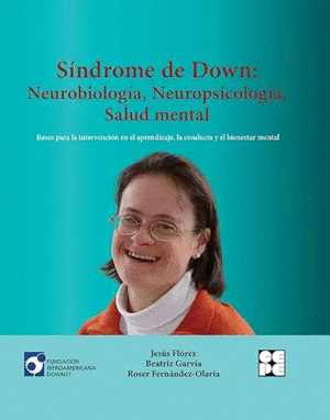 SINDROME DE DOWN:<BR>