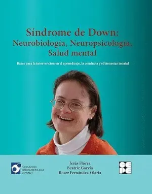 SINDROME DE DOWN:<BR>