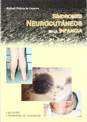 SINDROMES NEUROCUTANEOS EN LA INFANCIA
