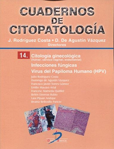 CUADERNOS DE CITOPATOLOGÍA 14. CITOLOGÍA GINECOLÓGICA: INFECCIONES FÚNGICAS.VIRUS DEL PAPILOMA HUMAN