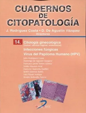 CUADERNOS DE CITOPATOLOGÍA 14. CITOLOGÍA GINECOLÓGICA: INFECCIONES FÚNGICAS.VIRUS DEL PAPILOMA HUMAN CUADERNOS DE CITOPATOLOGÍA 14. CITOLOGÍA GINECOLÓGICA: INFECCIONES FÚNGICAS.VIRUS DEL PAPILOMA HUMAN