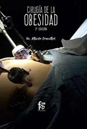 CIRUGÍA DE LA OBESIDAD CIRUGÍA DE LA OBESIDAD