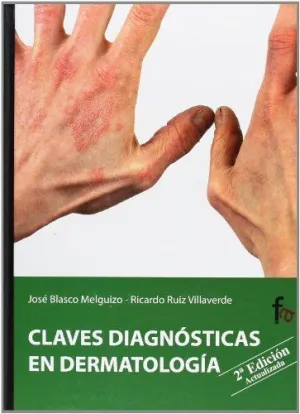 CLAVES DIAGNOSTICAS EN DERMATOLOGIA
